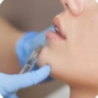 image Dermafiller